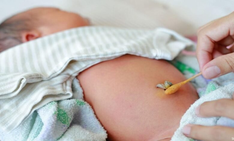 كيفية الاهتمام بسرة الطفل حديث الولادة