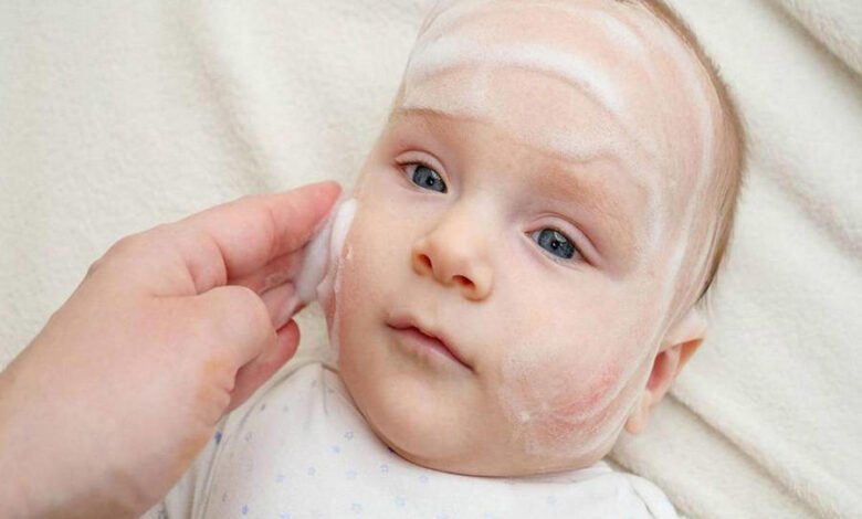 ما أسباب الطفح الجلدي عند الاطفال