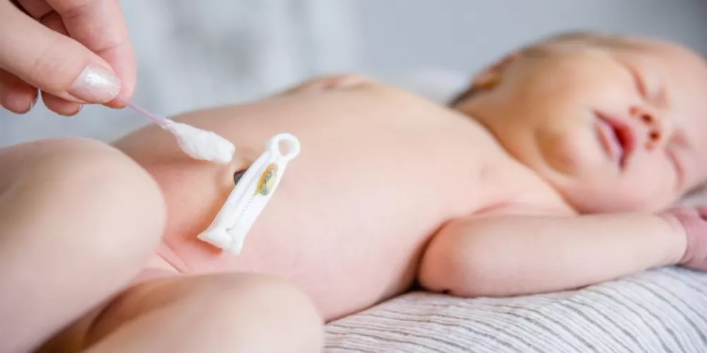 كيفية الاهتمام بسرة الطفل حديث الولادة