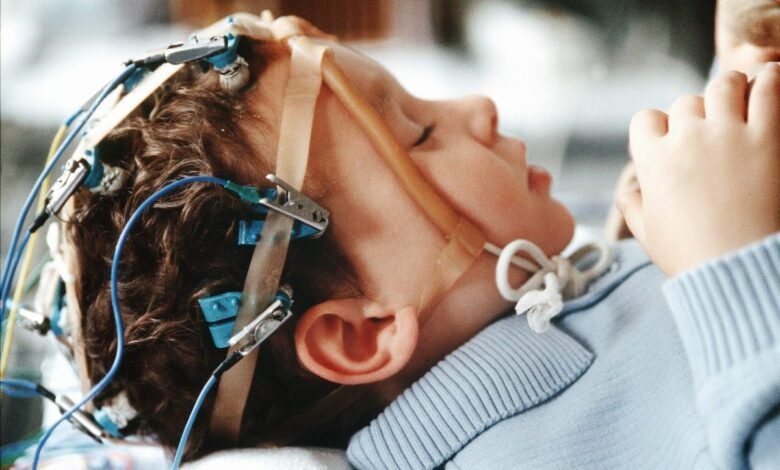 كهرباء المخ