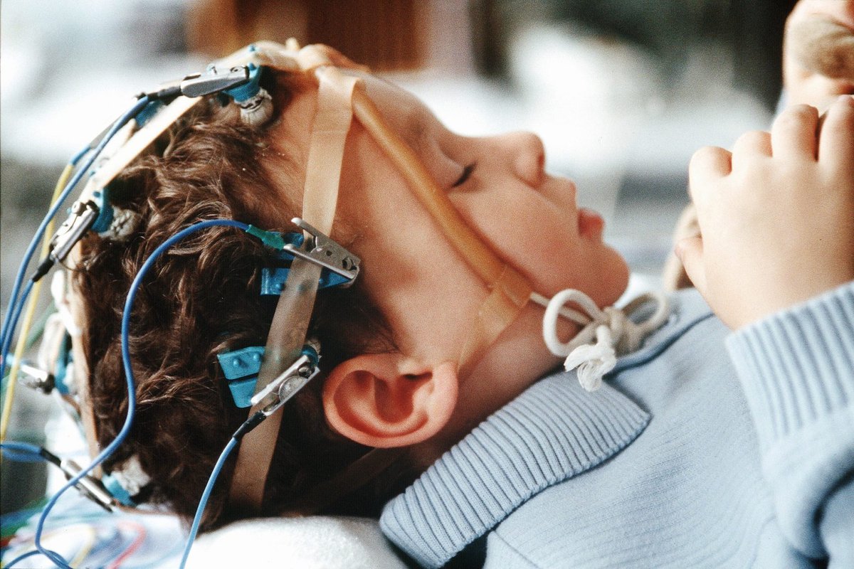  كهرباء المخ