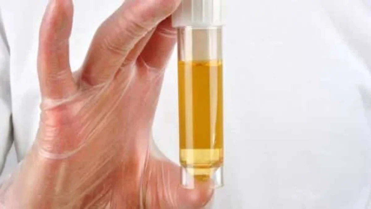 ما هي أسباب حرقان البول بعد الجماع؟