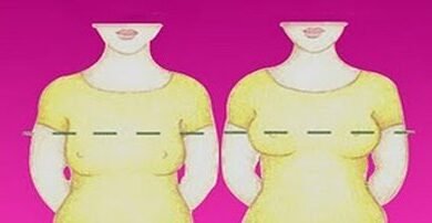 أسباب ترهل الثدي