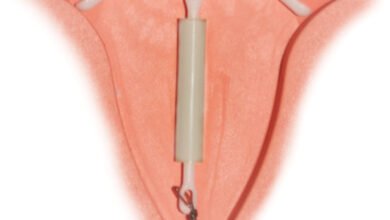 أنسب وسائل منع الحمل للمرضع