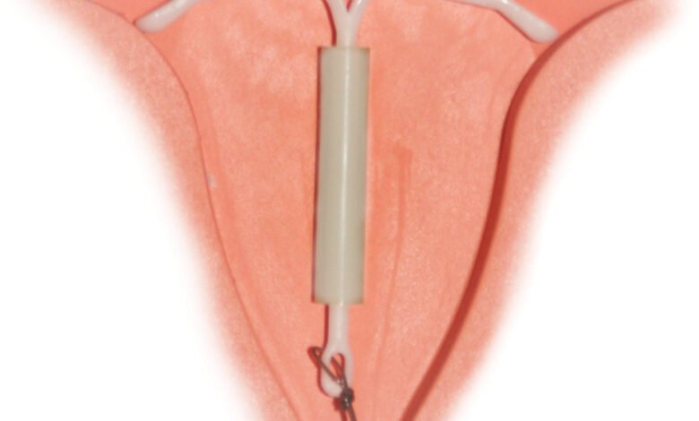 أنسب وسائل منع الحمل للمرضع