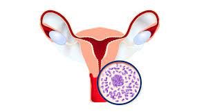 أنواع الإفرازات عند المرأة