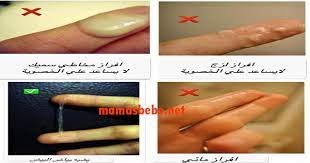 أنواع الإفرازات عند المرأة