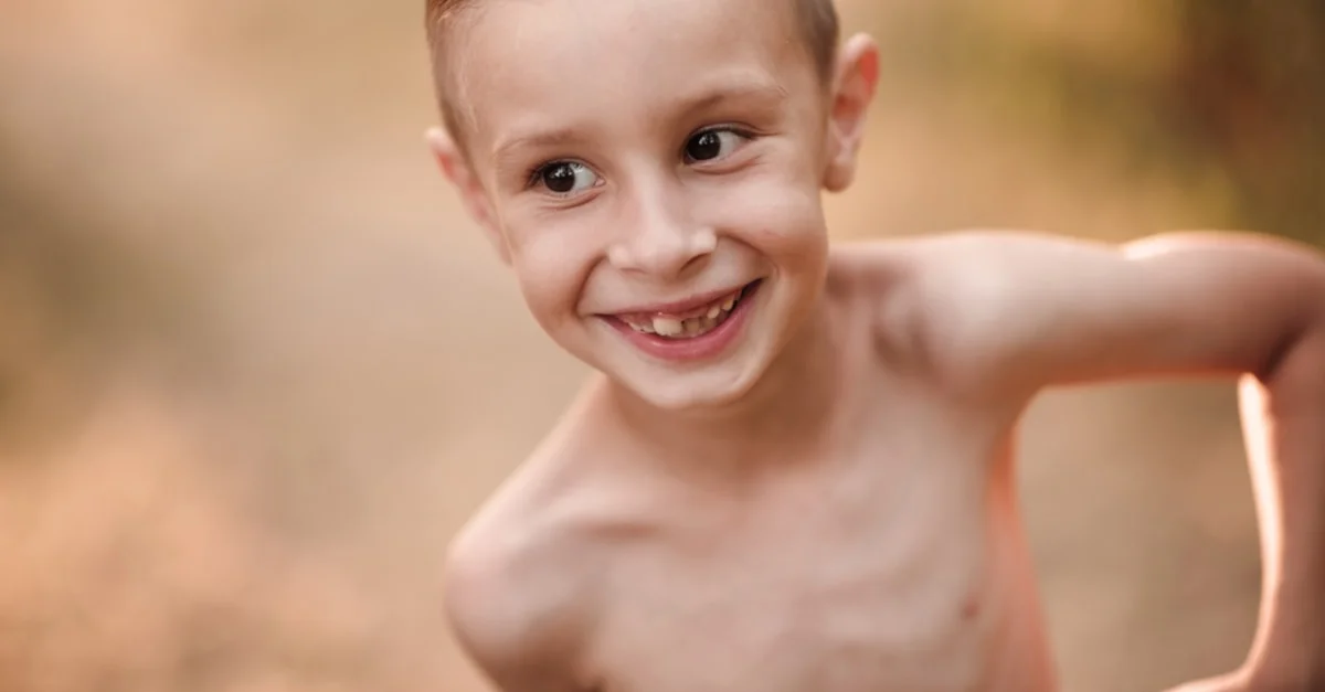 علاج الطفل الهزيل ... 7 أسباب لنقصان وزن الطفل وعلاجها