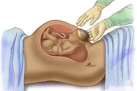 مميزات الولادة الطبيعية