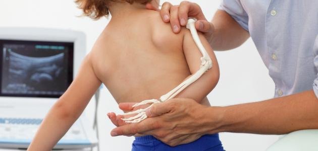 أفضل كالسيوم للاطفال الرضع