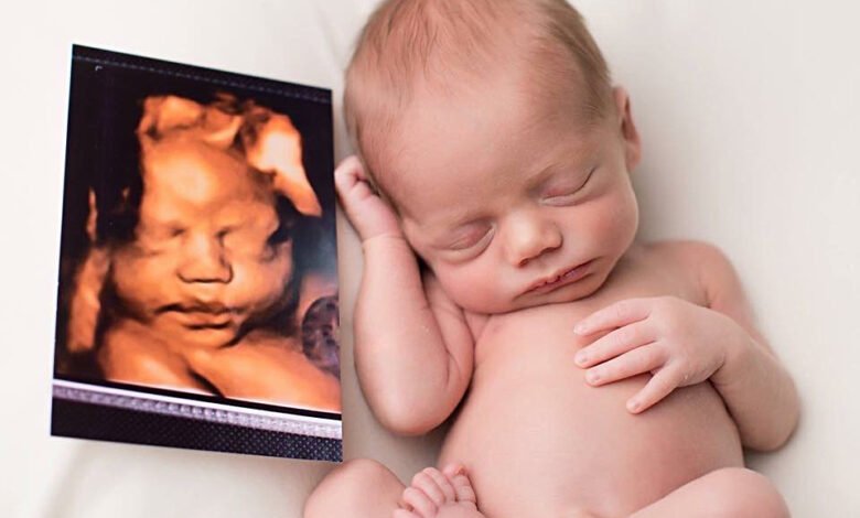 ما الوقت المناسب لإجراء أشعة 4D للحامل