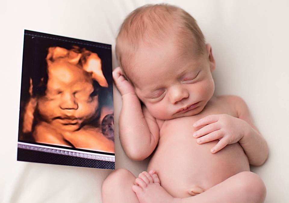 ما الوقت المناسب لإجراء أشعة 4D للحامل