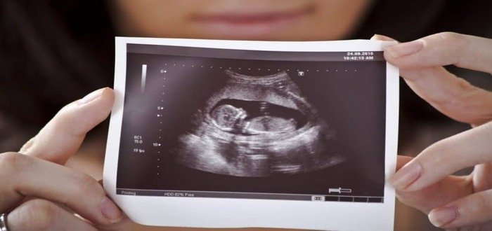 ما الوقت المناسب لإجراء أشعة 4D للحامل ما الوقت المناسب لإجراء أشعة 4D للحامل