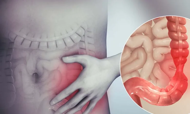 ما هو دواء Mephigastryl