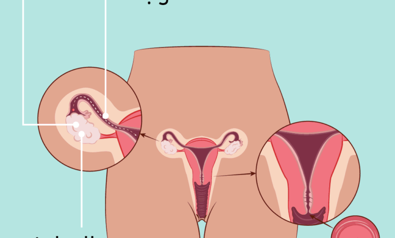 هل ينزل الوزن أثناء الدورة الشهرية؟