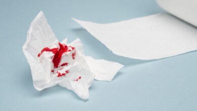 أسباب النزيف بعد الدورة الشهرية