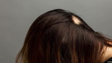 الفرق بين الثعلبة والفطريات