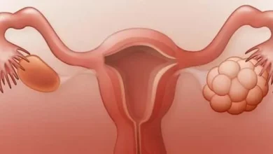 كيف ينزل كيس المبيض مع الدورة