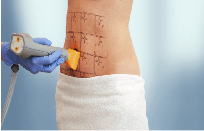 أشهر أسباب شد البطن