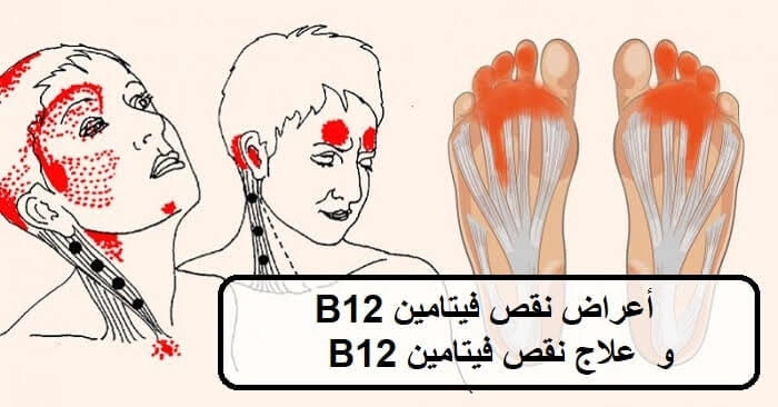 أعراض نقص فيتامين د و b12