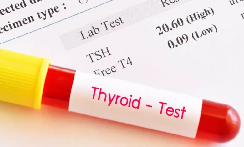 تحليل الغدة الدرقية