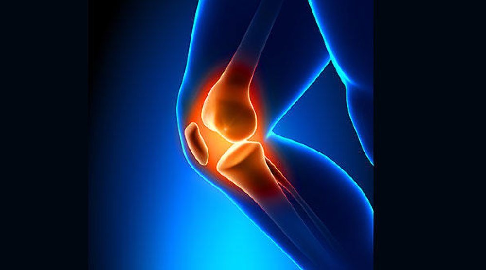 علاج خشونة الركبة