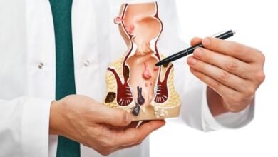 الناسور العصعصي