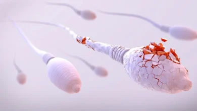 أعراض واضحة لضعف الحيوانات المنوية عند الزوج