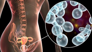 أنواع التهابات المهبل وأعراضها