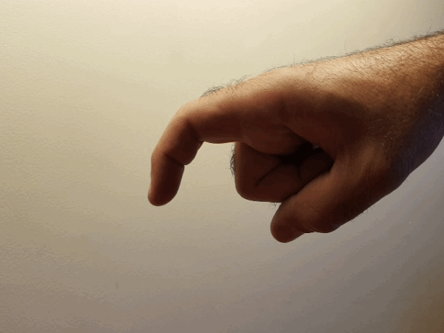 اعوجاج القضيب