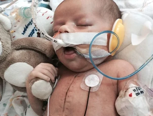 تجربة القلب المفتوح