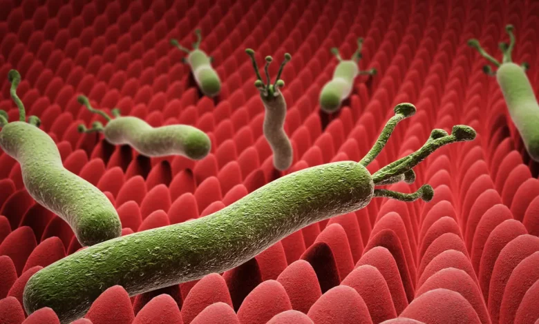 جرثومة المعدة