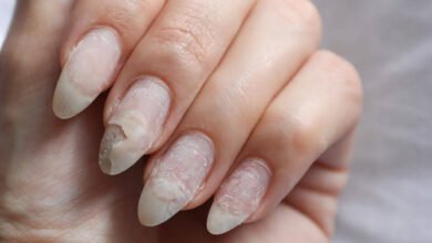 خطوات لعلاج الأظافر الضعيفة والمتشققة