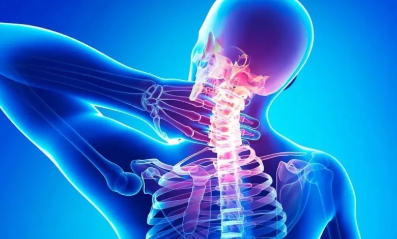 ضغط فقرات الرقبة على الأعصاب