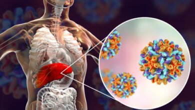 طرق علاج التهاب الكبد الفيروسي