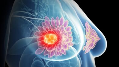 أسباب تكيسات الثدي وعلاجها